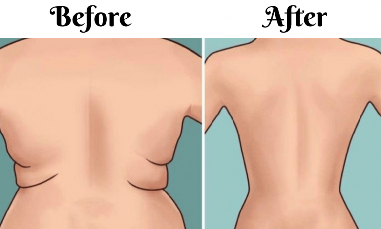 Get-Rid-Of-Back-Fat